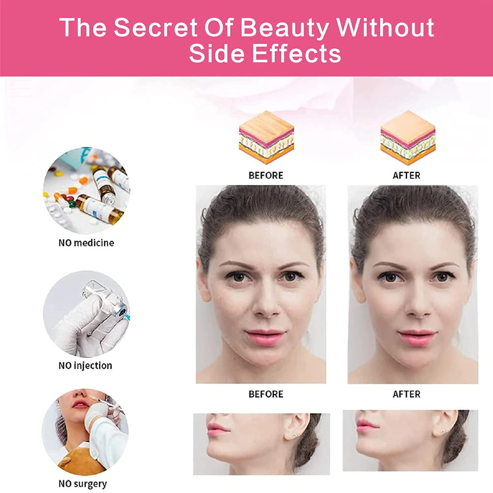 OGMart® Face Lifting Belt