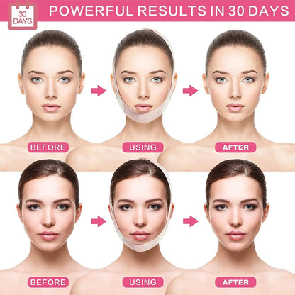 OGMart® Face Lifting Belt